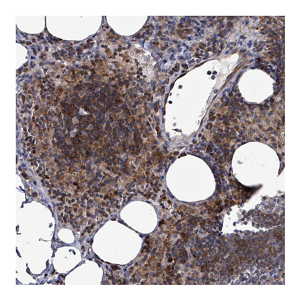 Atlas Antibodies Anti-LILRA4 Antibody