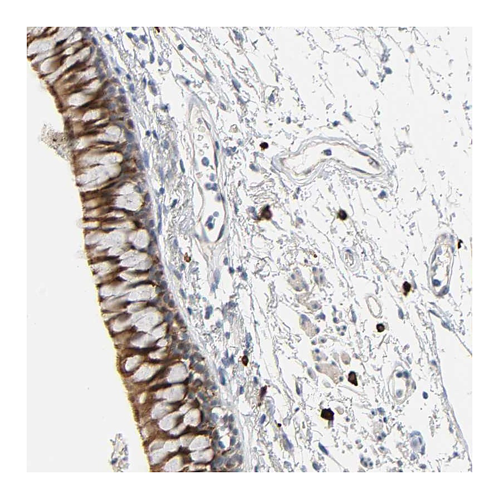 Atlas Antibodies Anti-LIMCH1 Antibody