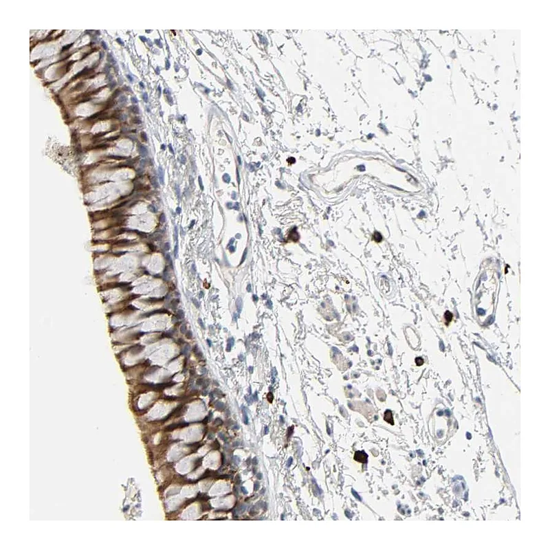 Atlas Antibodies Anti-LIMCH1 Antibody