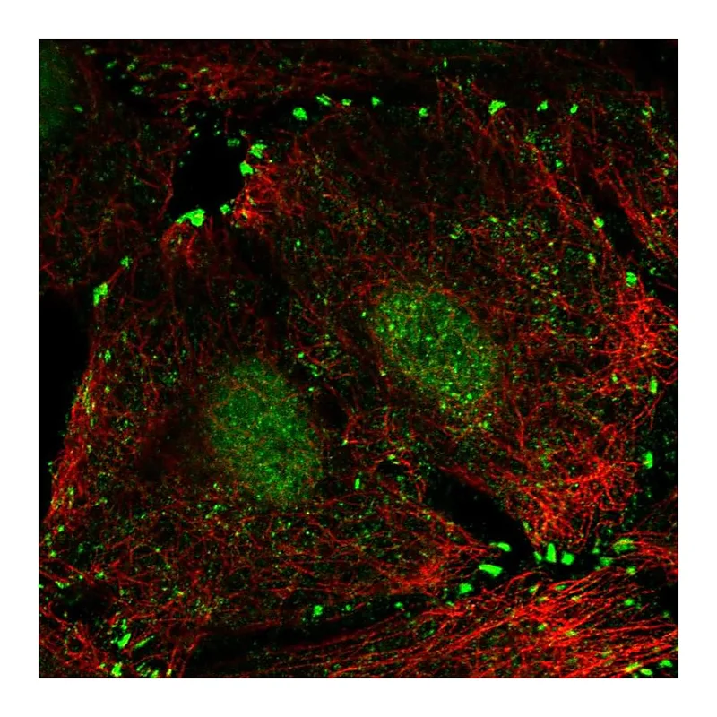 Atlas Antibodies Anti-LIMD1 Antibody