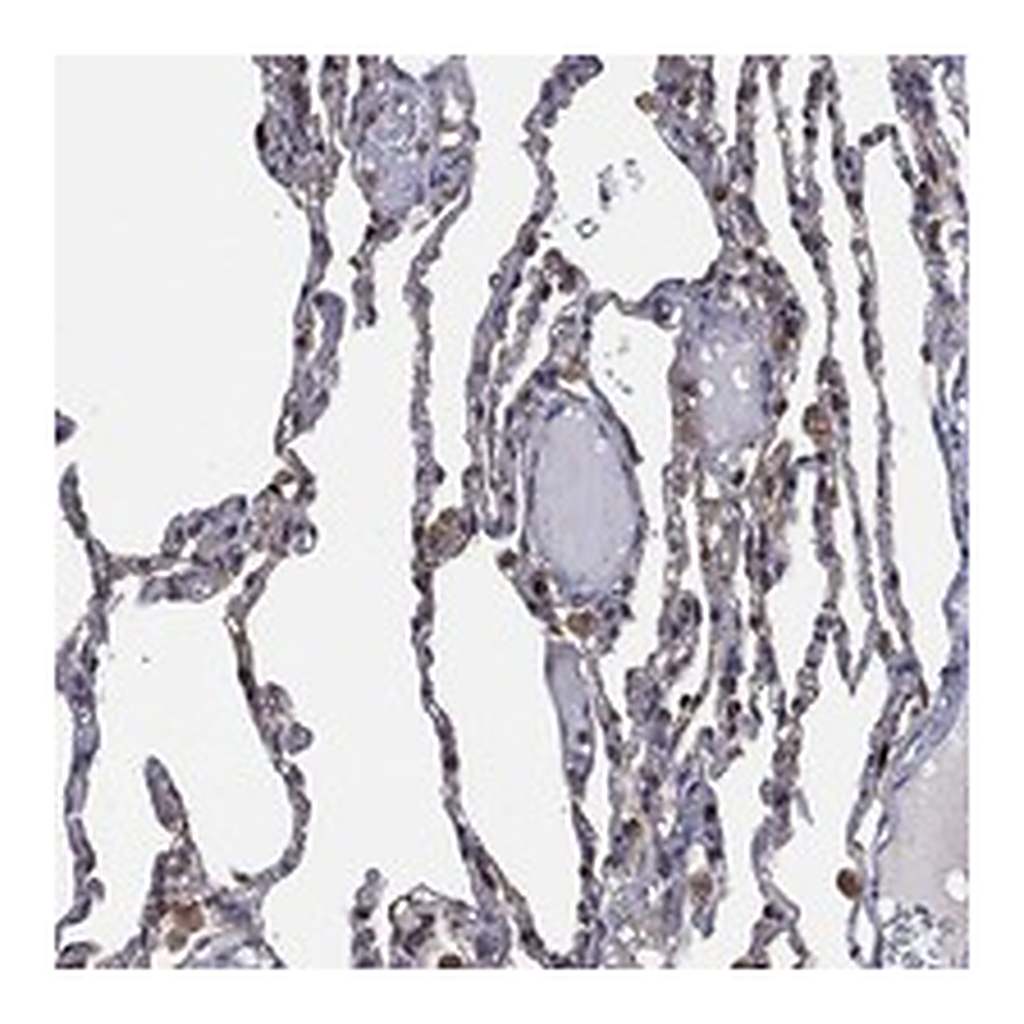 Atlas Antibodies Anti-LIMD1 Antibody