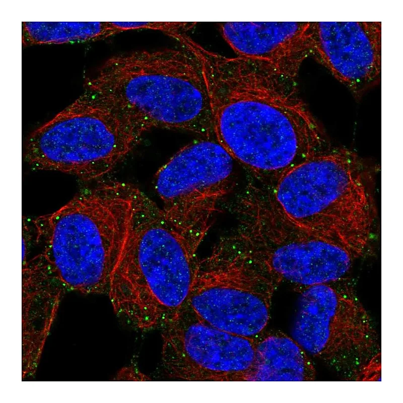 Atlas Antibodies Anti-LIMD2 Antibody