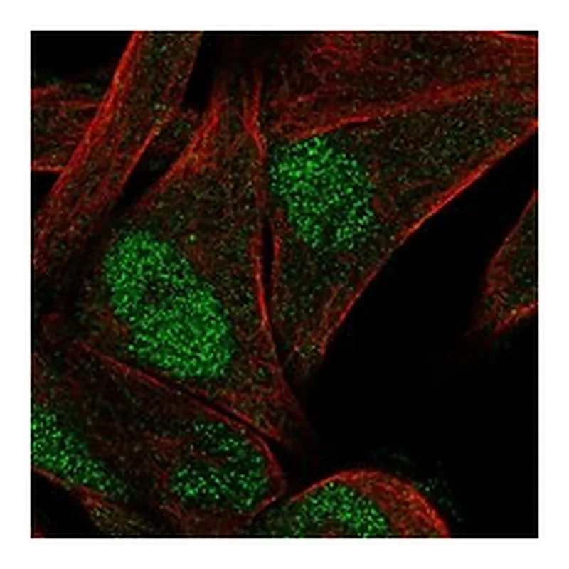 Atlas Antibodies Anti-LIMD2 Antibody