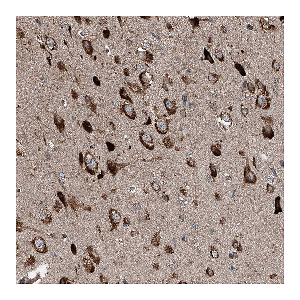Atlas Antibodies Anti-LIMK1 Antibody