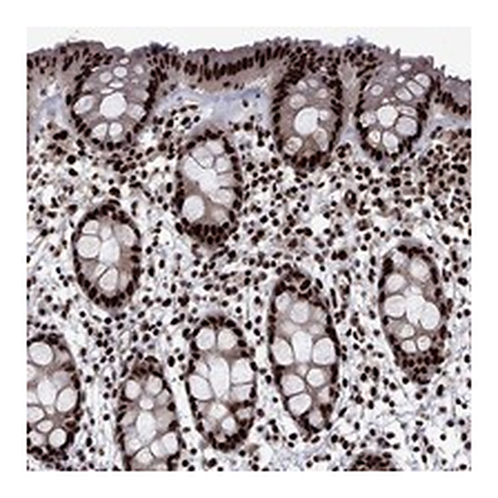 Atlas Antibodies Anti-LIMK1 Antibody
