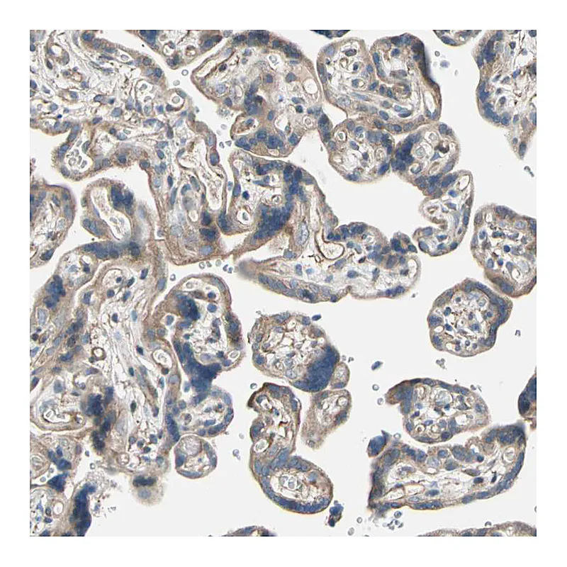 Atlas Antibodies Anti-LIMK2 Antibody