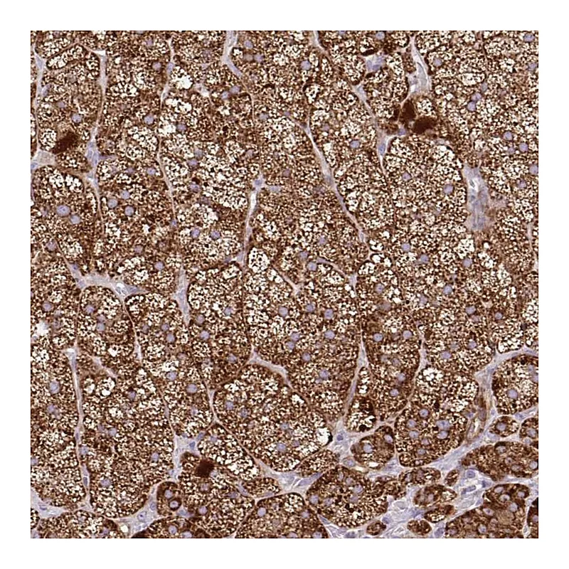 Atlas Antibodies Anti-LIMS1 Antibody