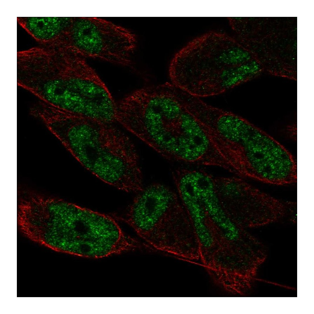 Atlas Antibodies Anti-LIN52 Antibody