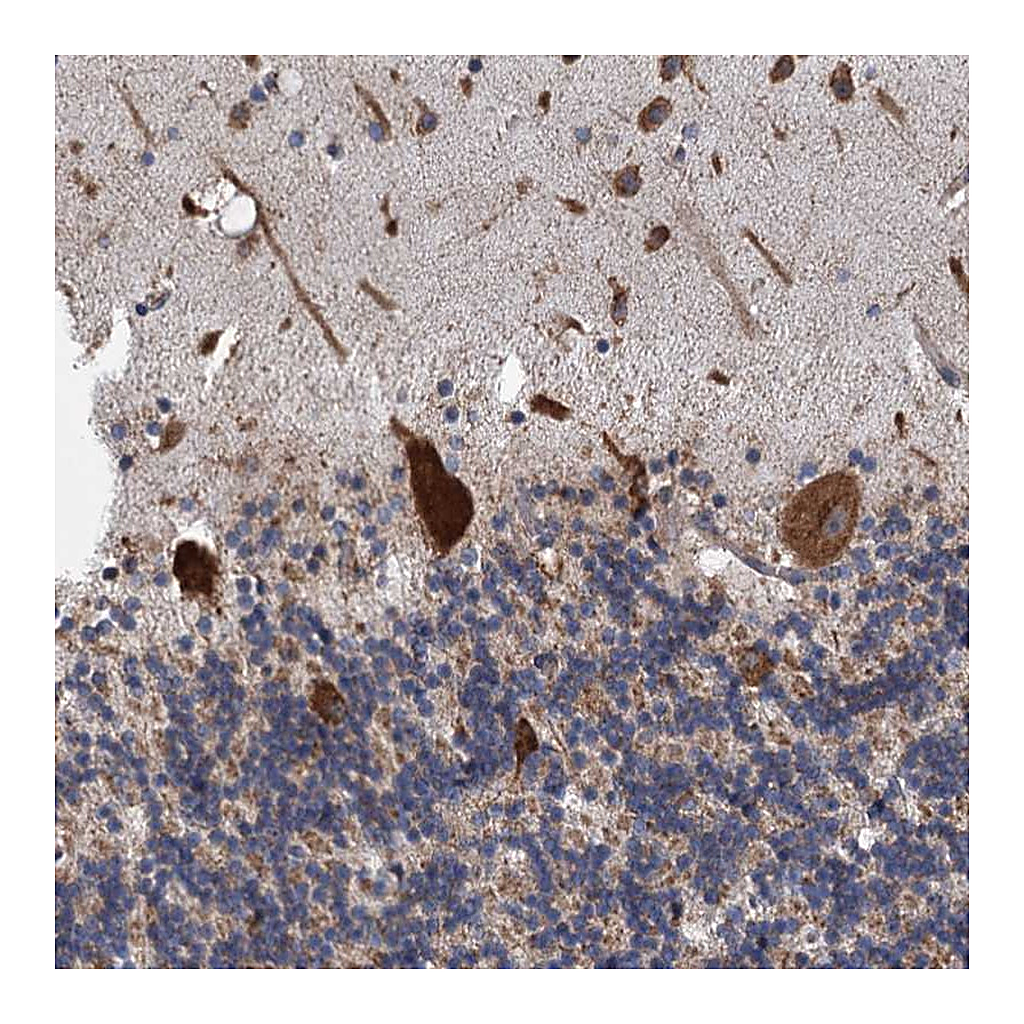Atlas Antibodies Anti-LINS1 Antibody