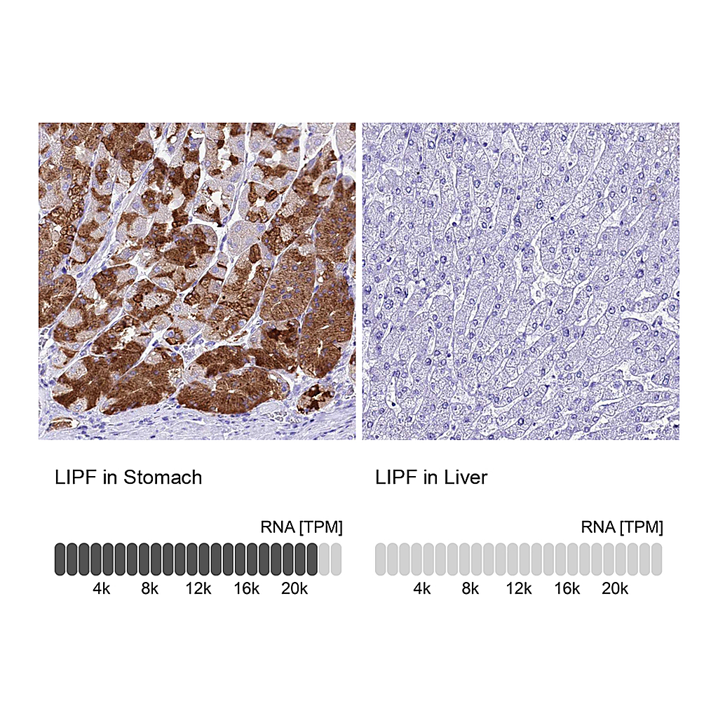Atlas Antibodies Anti-LIPF Antibody