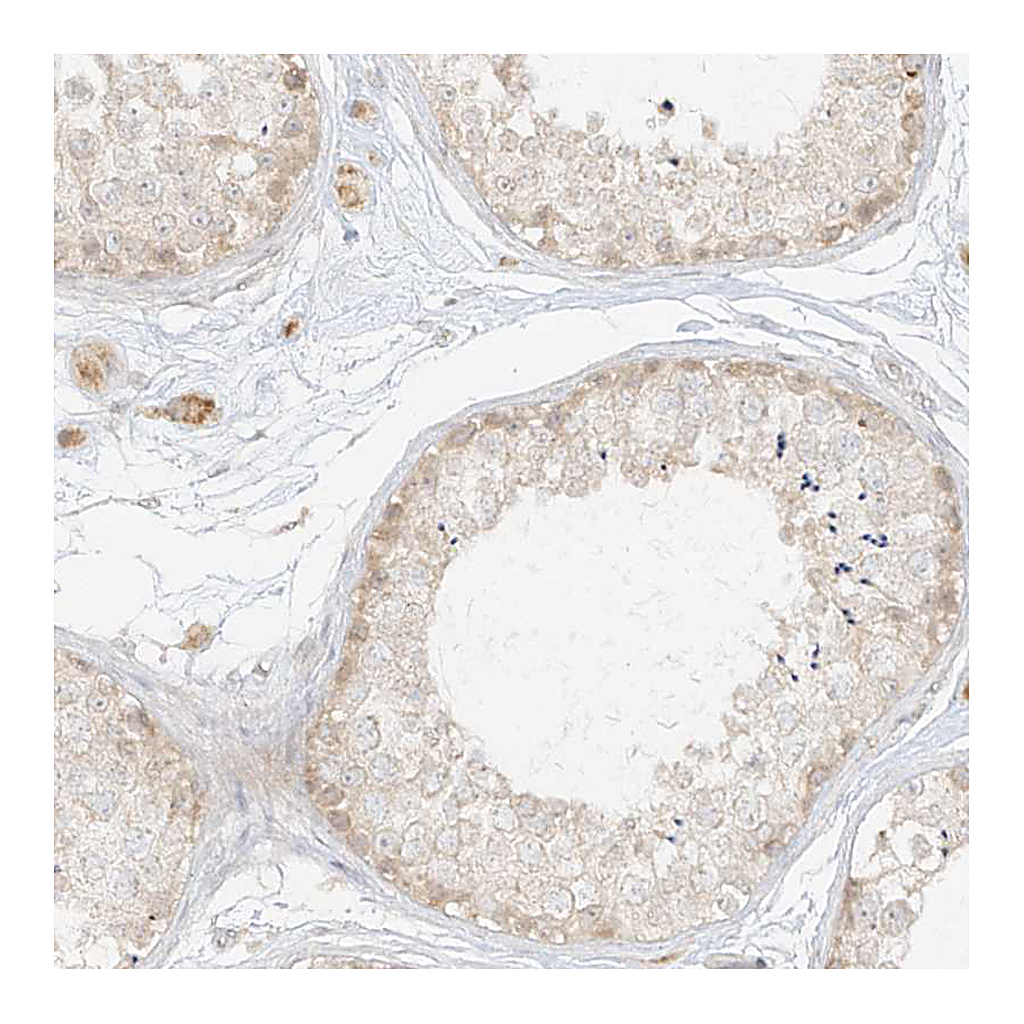Atlas Antibodies Anti-LIPT1 Antibody