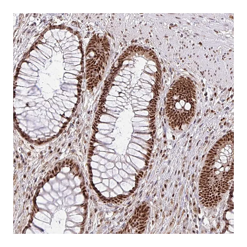 Atlas Antibodies Anti-LKAAEAR1 Antibody