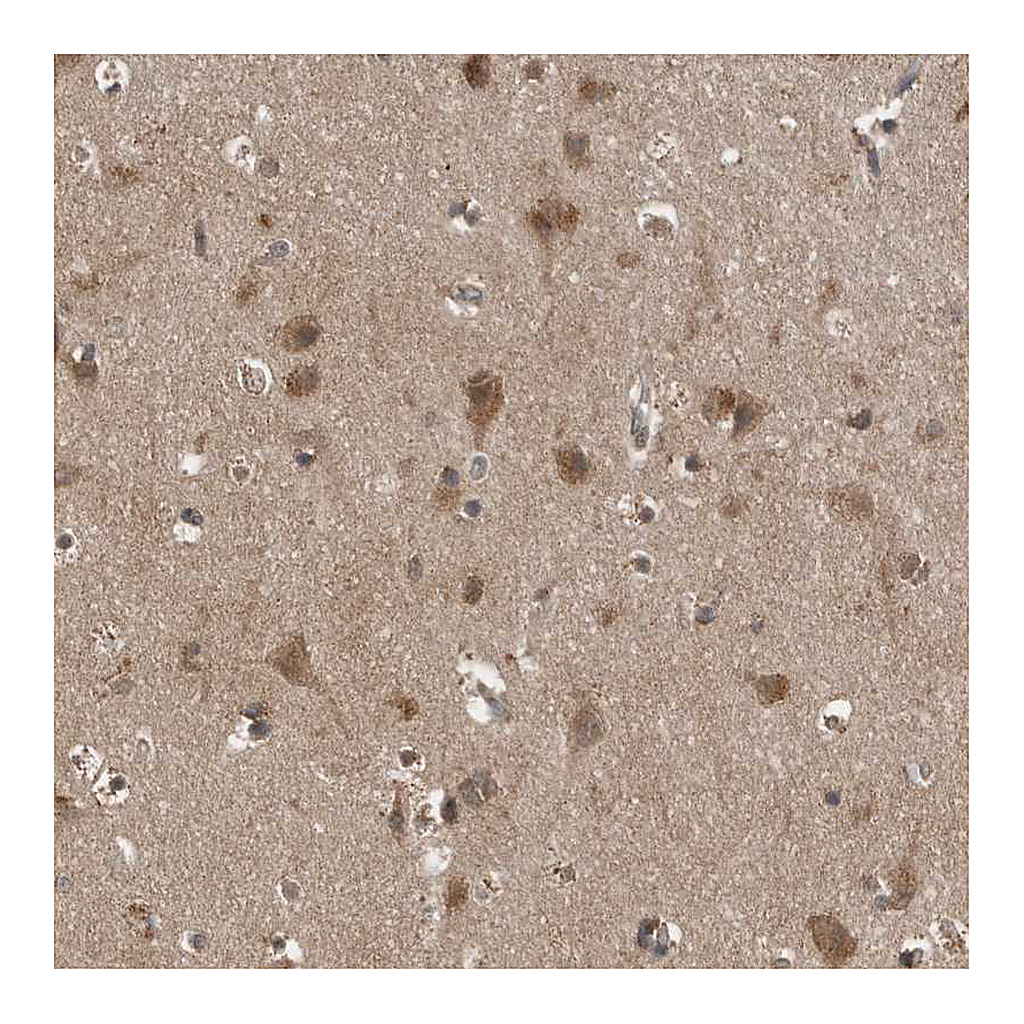 Atlas Antibodies Anti-LLGL1 Antibody