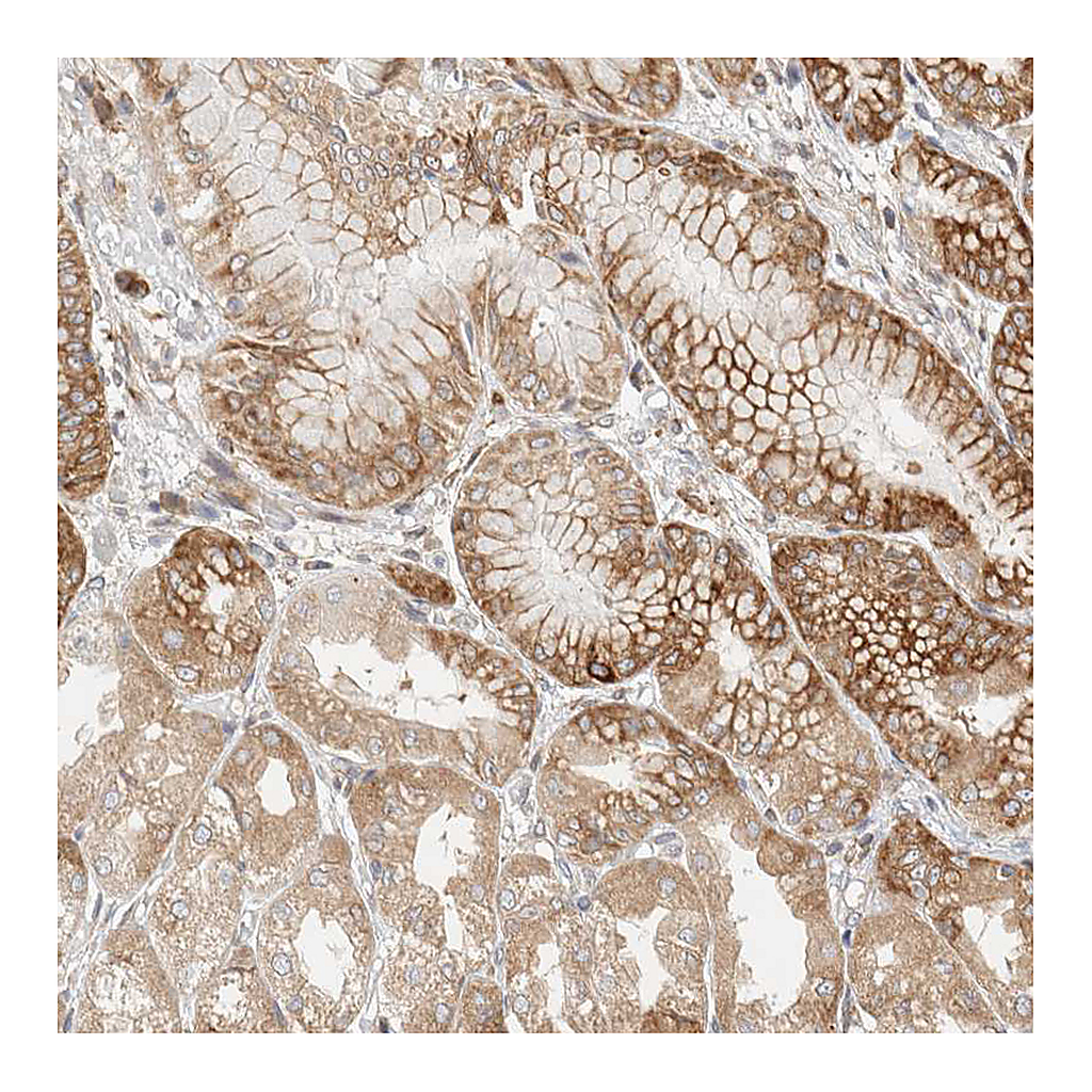 Atlas Antibodies Anti-LLGL2 Antibody