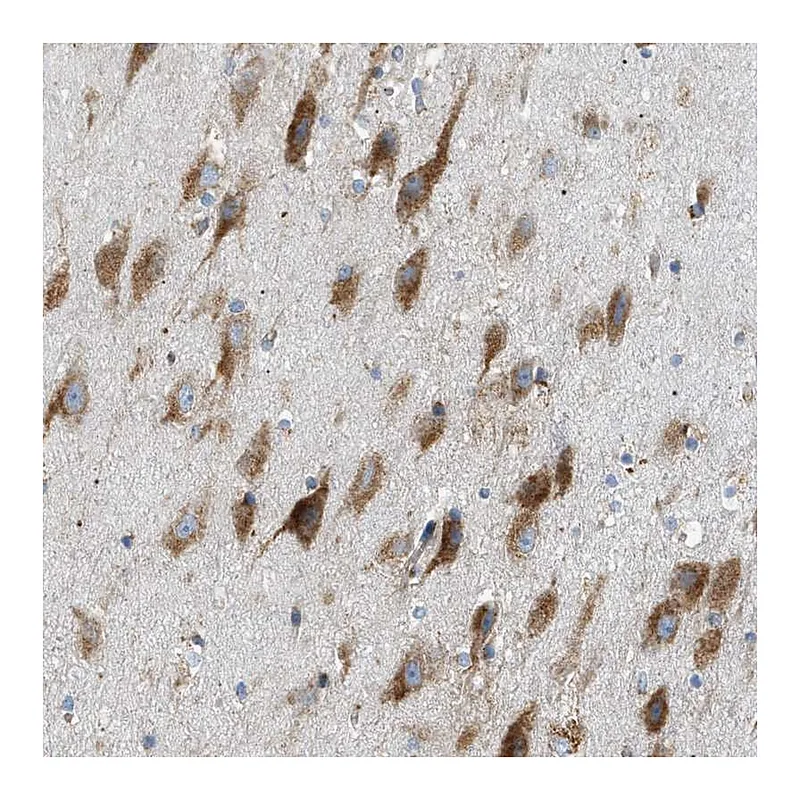 Atlas Antibodies Anti-LMBRD1 Antibody