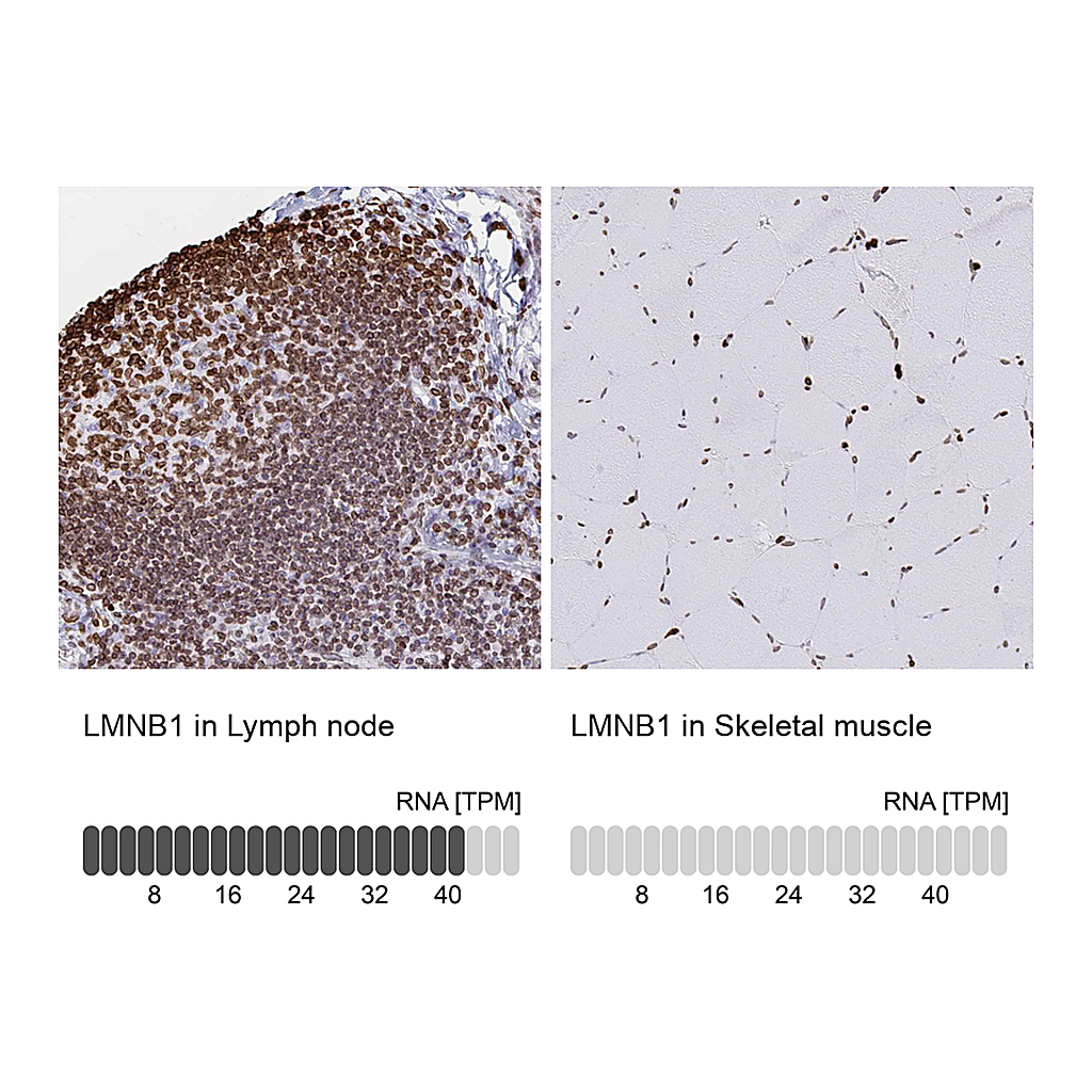 Atlas Antibodies Anti-LMNB1 Antibody