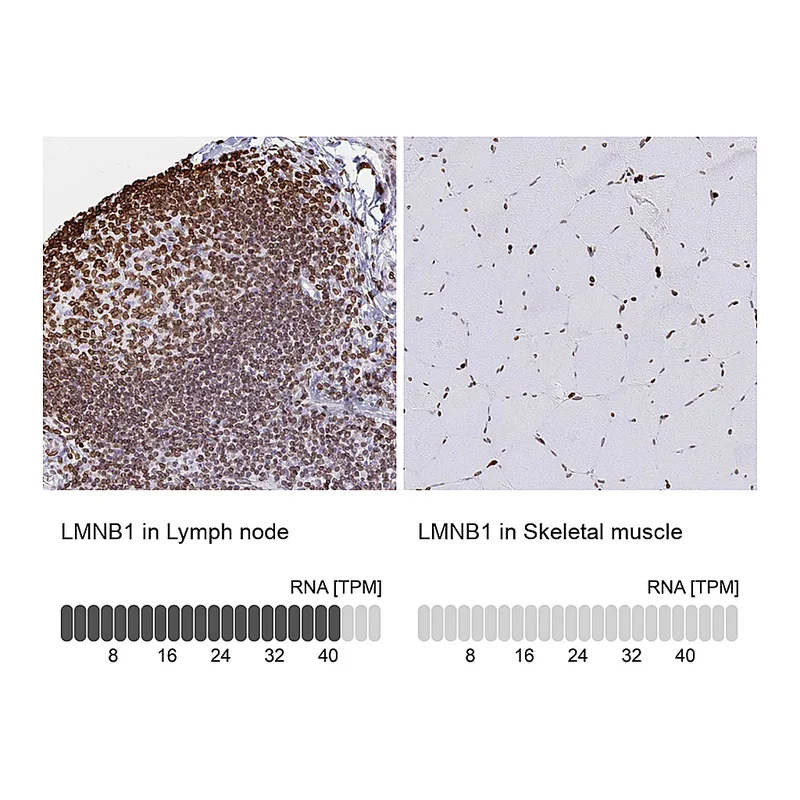 Atlas Antibodies Anti-LMNB1 Antibody