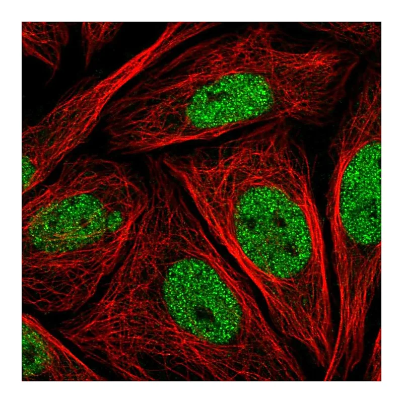 Atlas Antibodies Anti-LMO4 Antibody