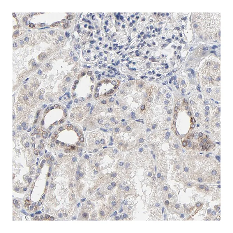 Atlas Antibodies Anti-LNX1 Antibody
