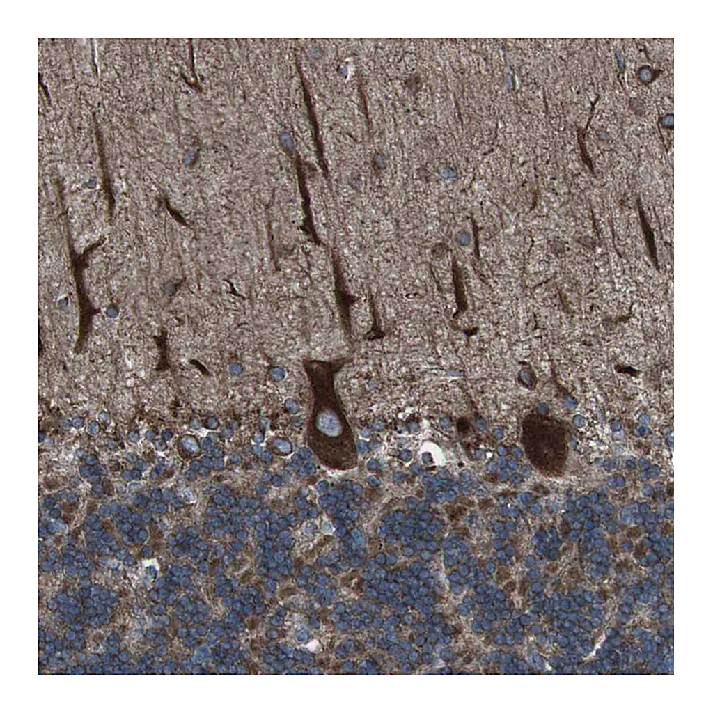 Atlas Antibodies Anti-LNPK Antibody