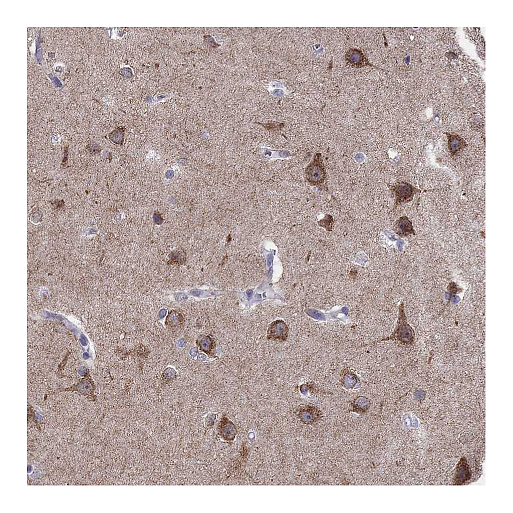 Atlas Antibodies Anti-LMTK3 Antibody
