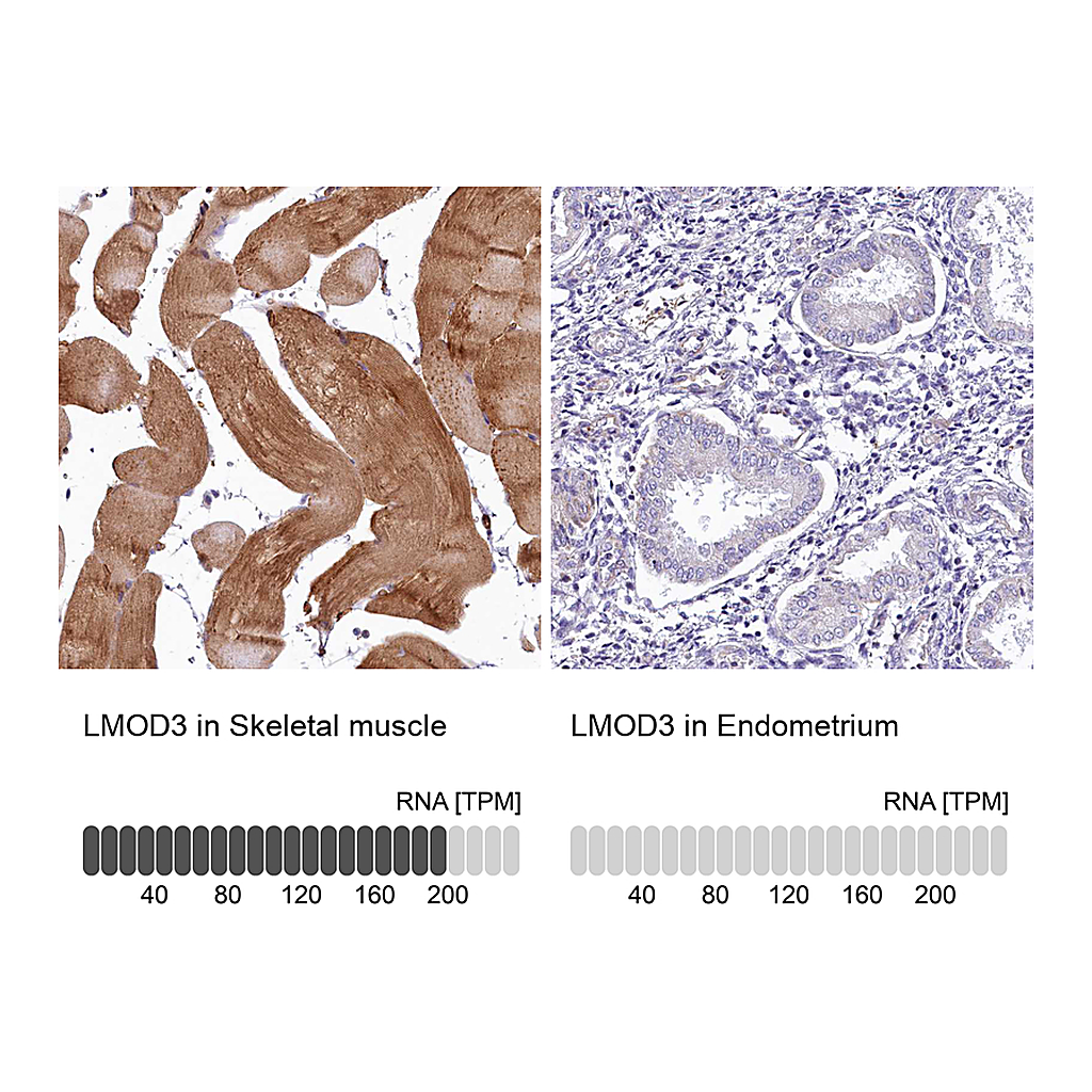Atlas Antibodies Anti-LMOD3 Antibody