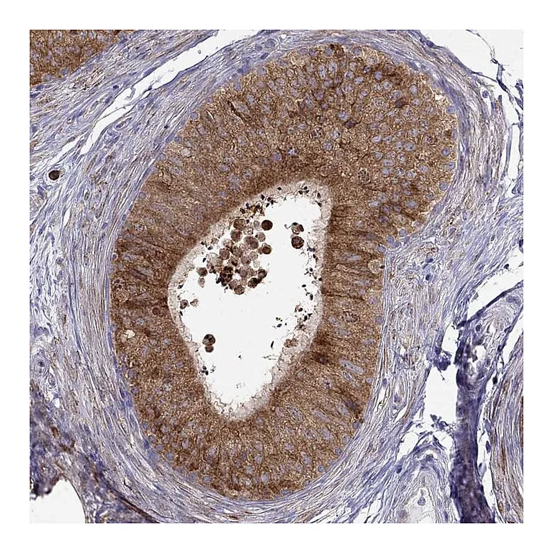 Atlas Antibodies Anti-LONRF2 Antibody