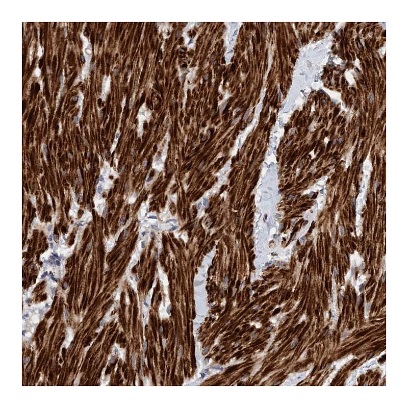 Atlas Antibodies Anti-LONRF1 Antibody