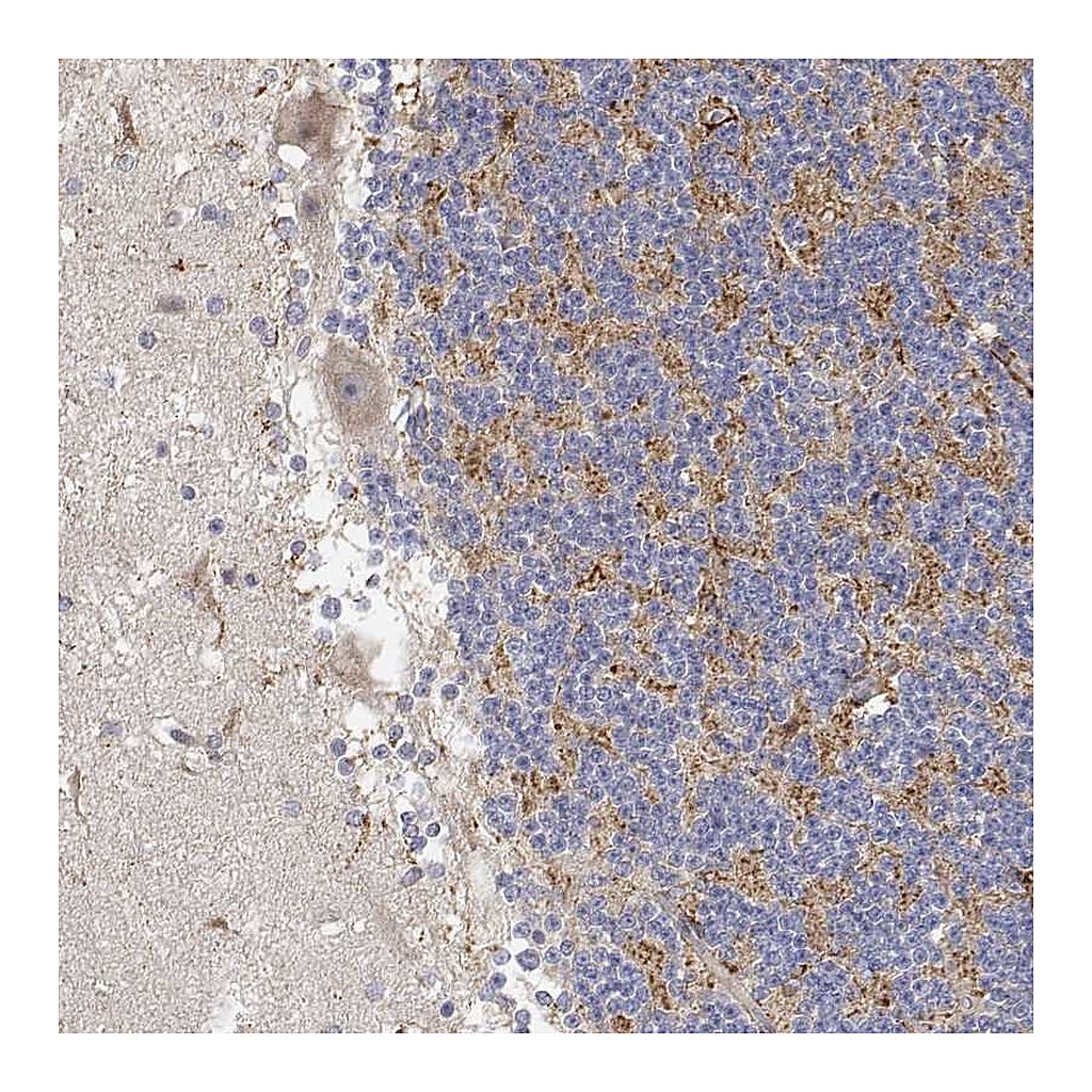 Atlas Antibodies Anti-LONRF3 Antibody