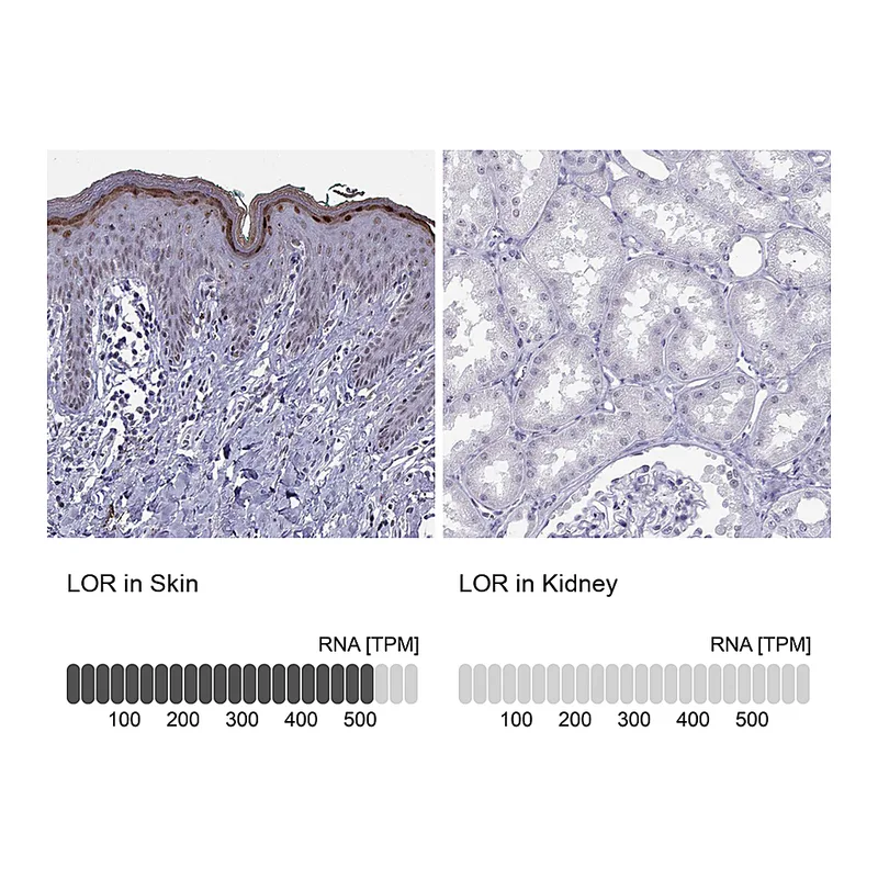 Atlas Antibodies Anti-LOR Antibody