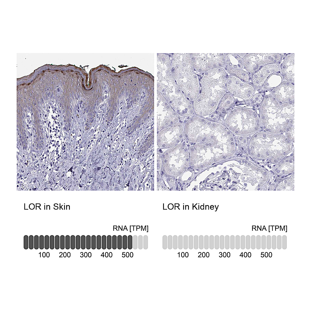 Atlas Antibodies Anti-LOR Antibody