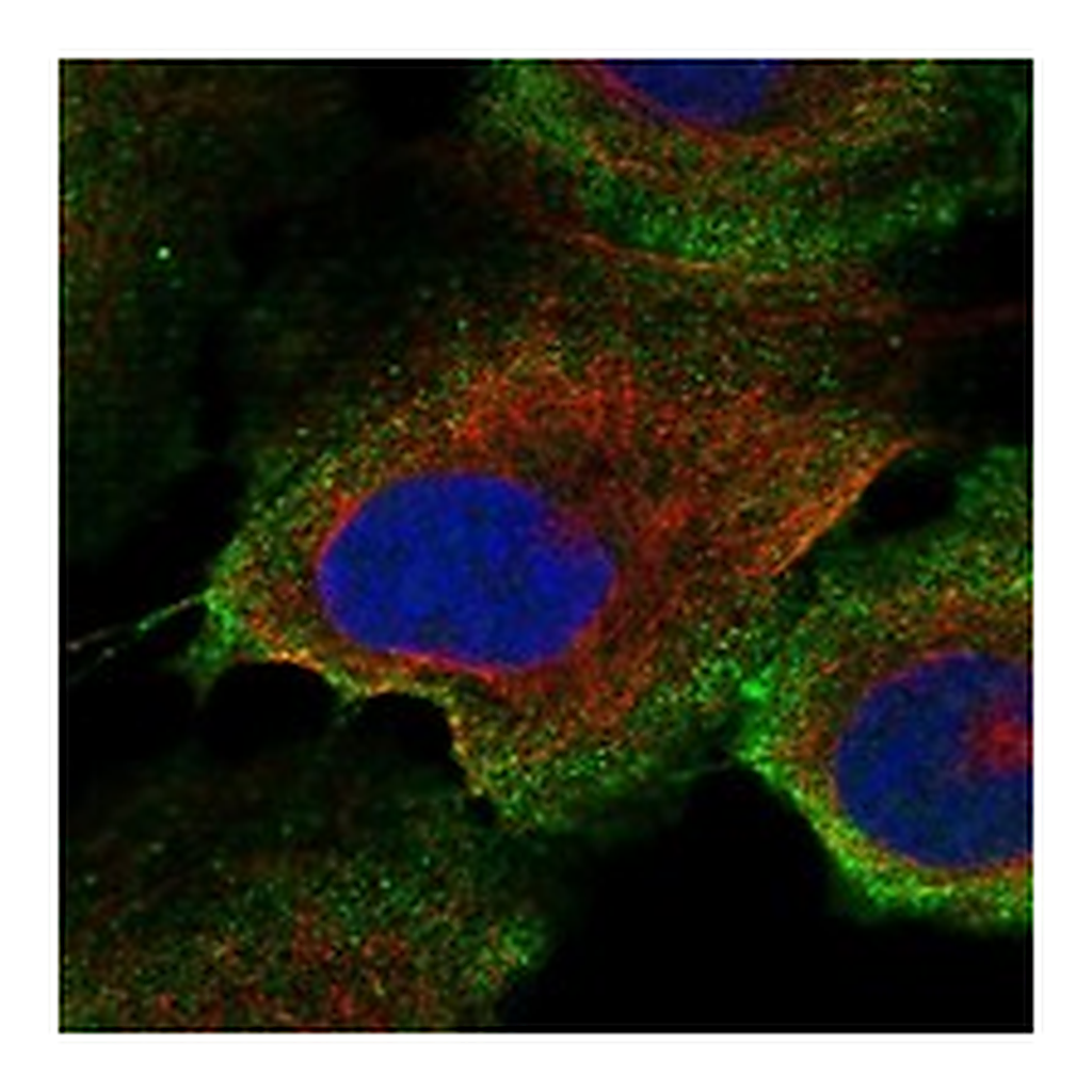 Atlas Antibodies Anti-LOXHD1 Antibody