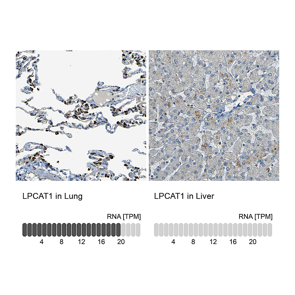Atlas Antibodies Anti-LPCAT1 Antibody