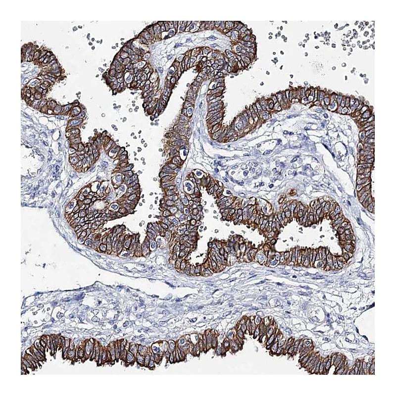 Atlas Antibodies Anti-ADGRL1 Antibody