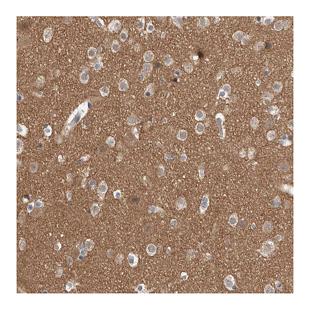 Atlas Antibodies Anti-ADGRL3 Antibody
