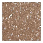 Atlas Antibodies Anti-ADGRL3 Antibody