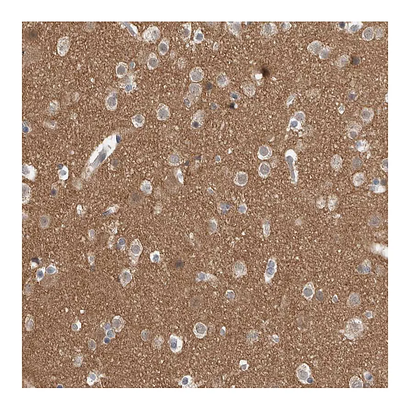 Atlas Antibodies Anti-ADGRL3 Antibody