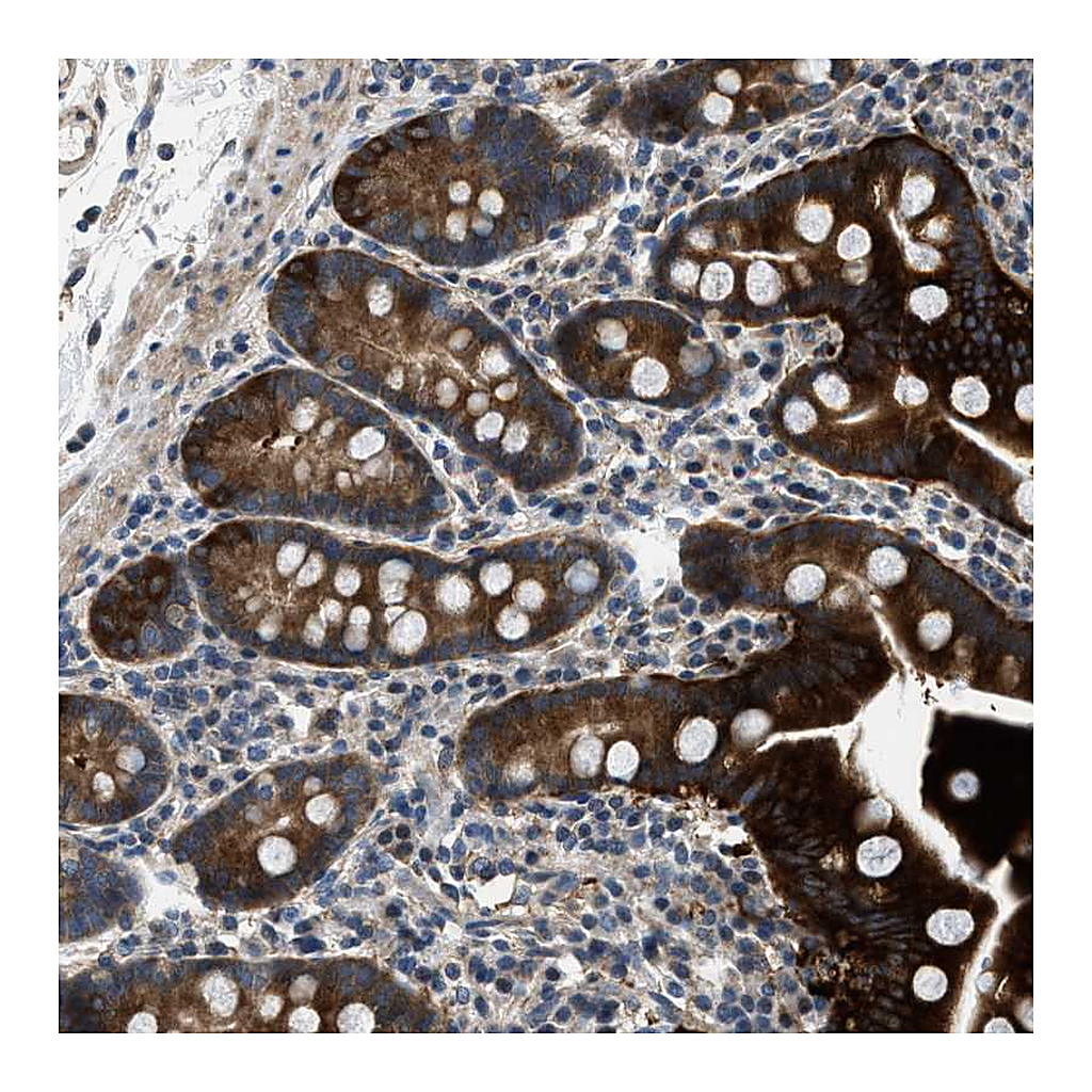 Atlas Antibodies Anti-LPIN2 Antibody