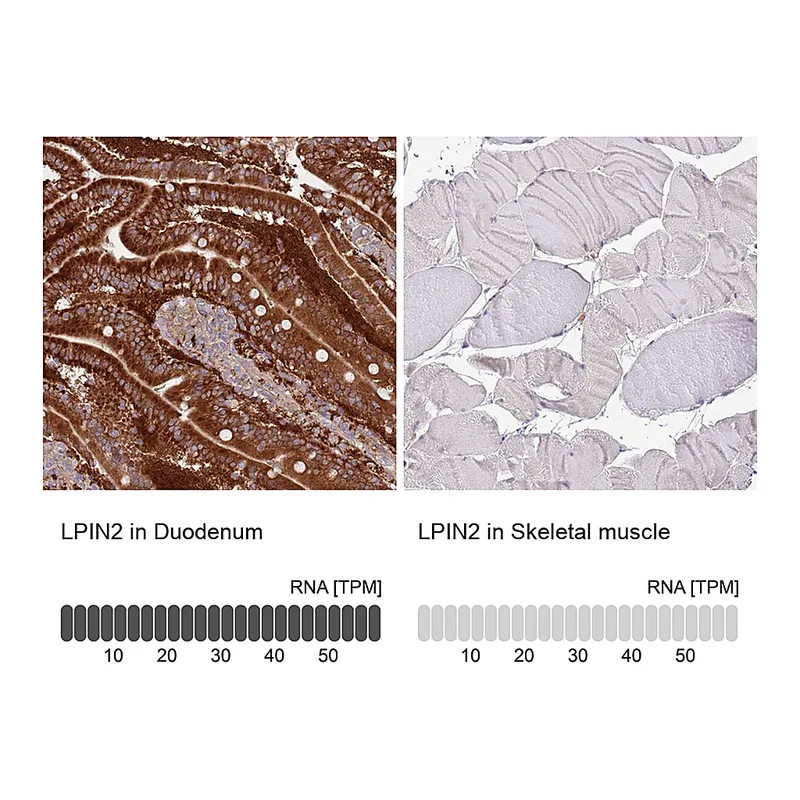 Atlas Antibodies Anti-LPIN2 Antibody