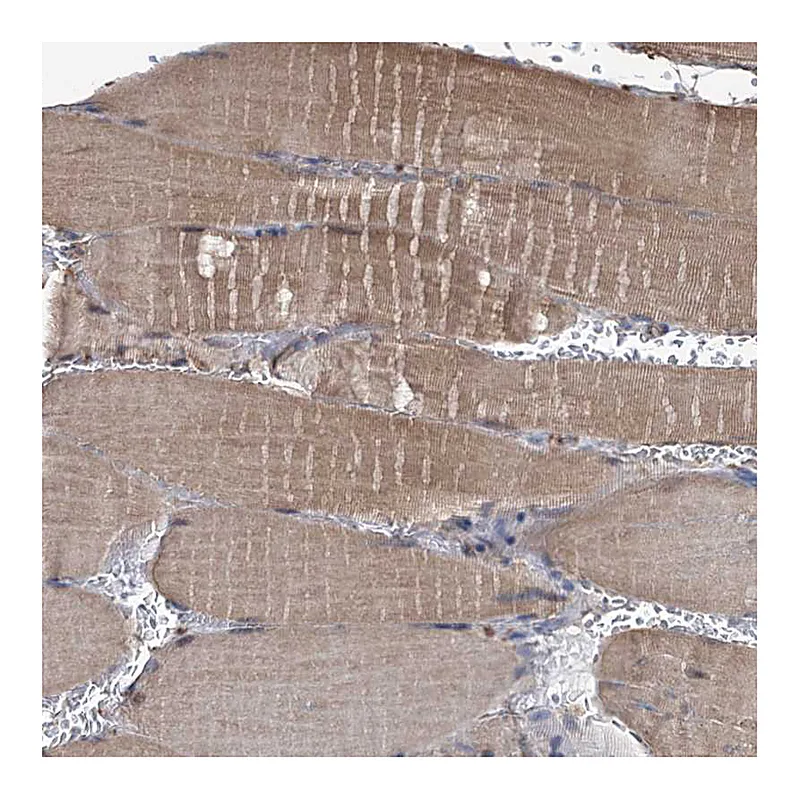 Atlas Antibodies Anti-LPIN1 Antibody