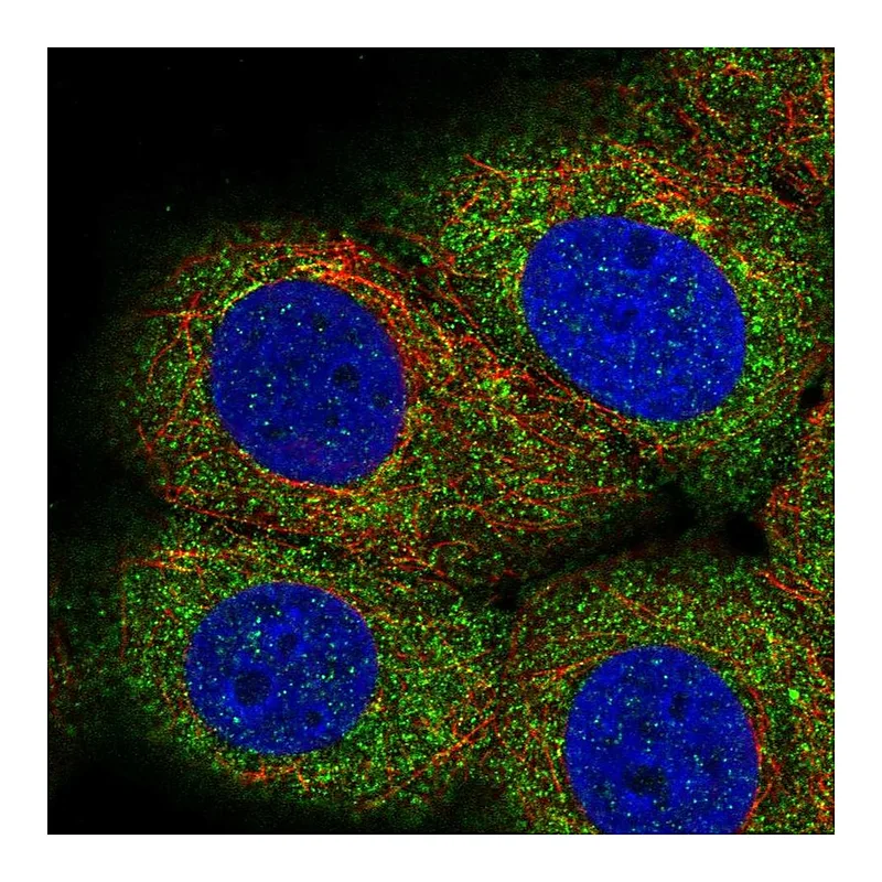Atlas Antibodies Anti-LPIN3 Antibody