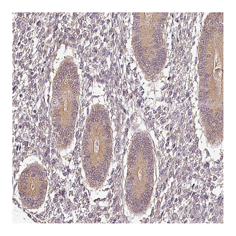 Atlas Antibodies Anti-ADH5 Antibody