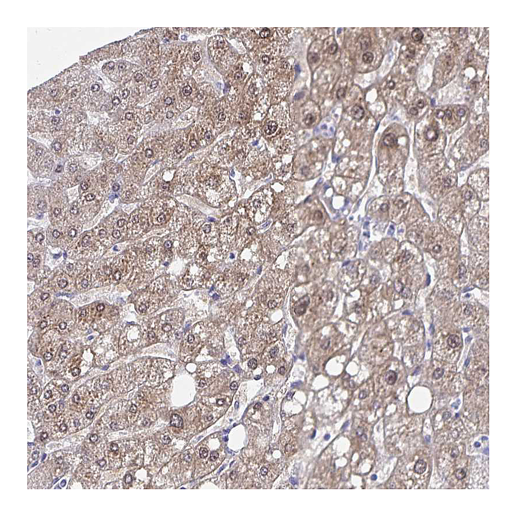Atlas Antibodies Anti-ADH1A Antibody