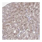 Atlas Antibodies Anti-ADH1A Antibody