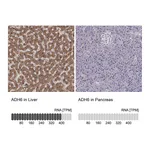 Atlas Antibodies Anti-ADH6 Antibody