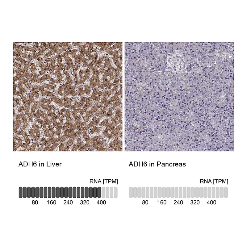 Atlas Antibodies Anti-ADH6 Antibody