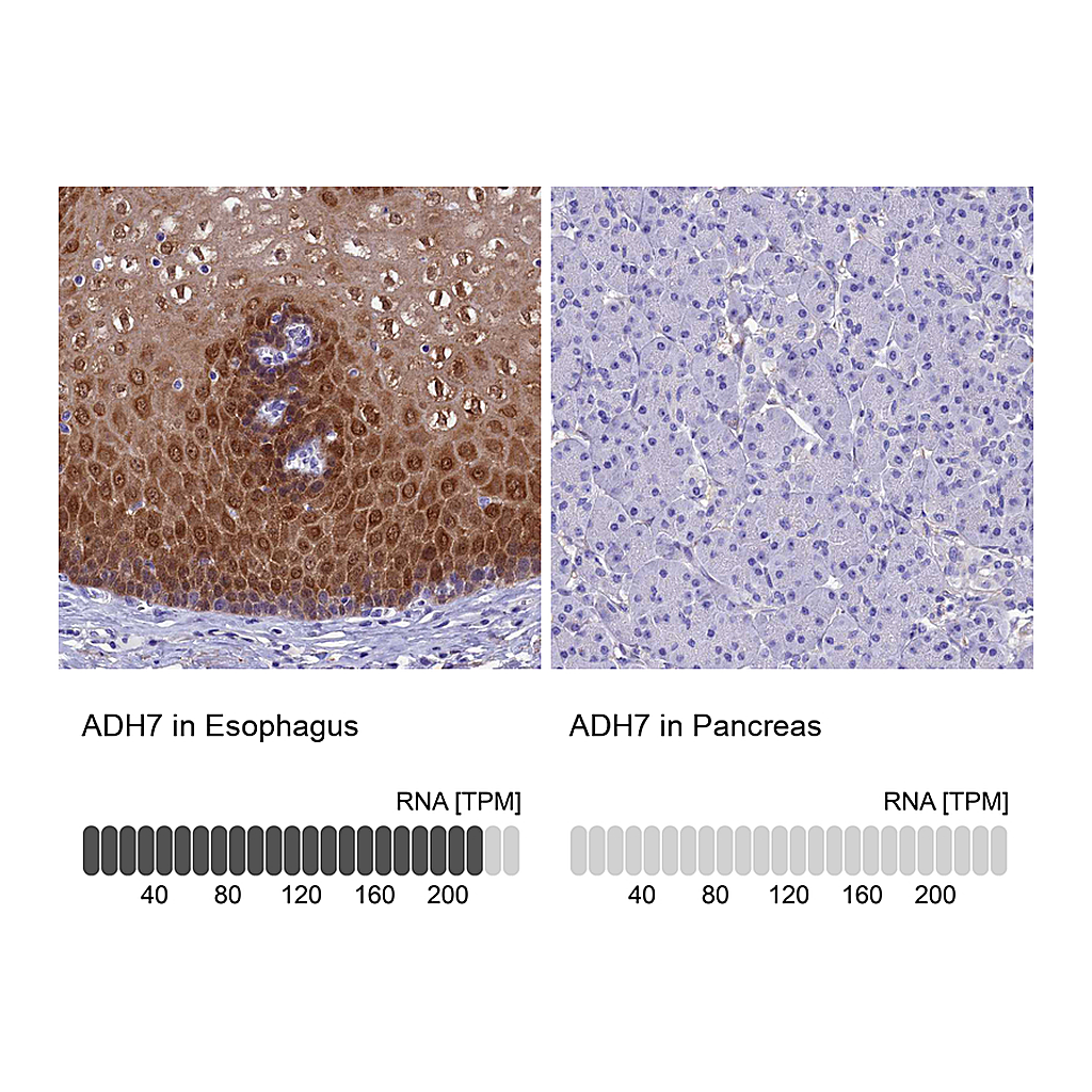 Atlas Antibodies Anti-ADH7 Antibody