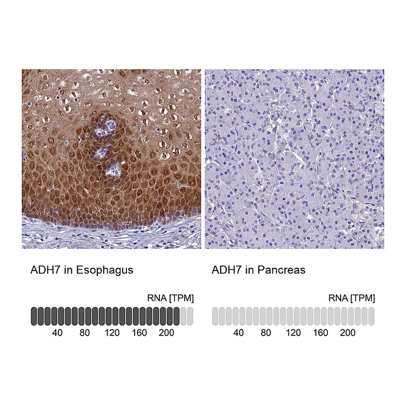 Atlas Antibodies Anti-ADH7 Antibody