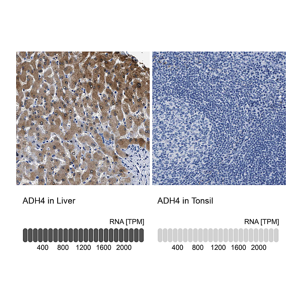 Atlas Antibodies Anti-ADH4 Antibody