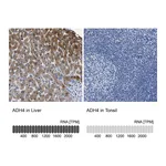 Atlas Antibodies Anti-ADH4 Antibody